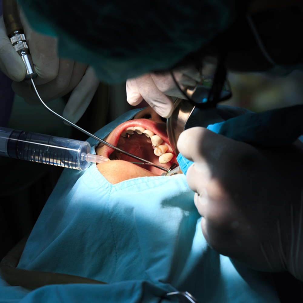 Maxillofacial surgery